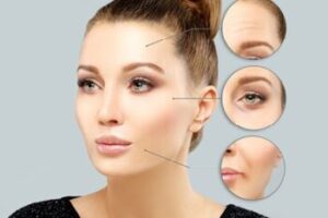 متخصص تزریق بوتاکس کرمانشاه