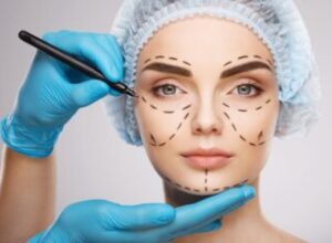 جراحی زیبایی صورت کرمانشاه